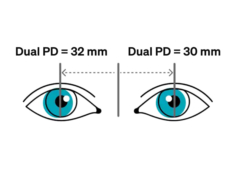 Dual pupillary distance.