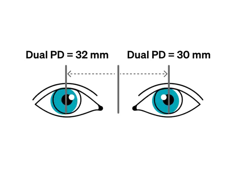 Dual pupillary distance.