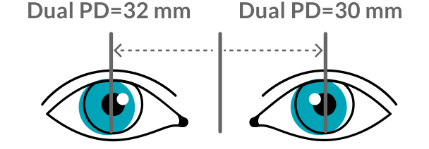 Dual pupillary distance.