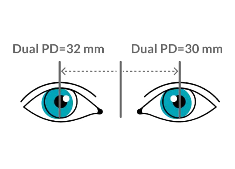 Dual pupillary distance.